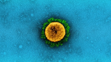 Mikroskopische Aufnahme eines SARS-CoV-2-Viruspartikels | Bild: picture alliance / BSIP | IMAGE POINT FR / NIH / NIAID