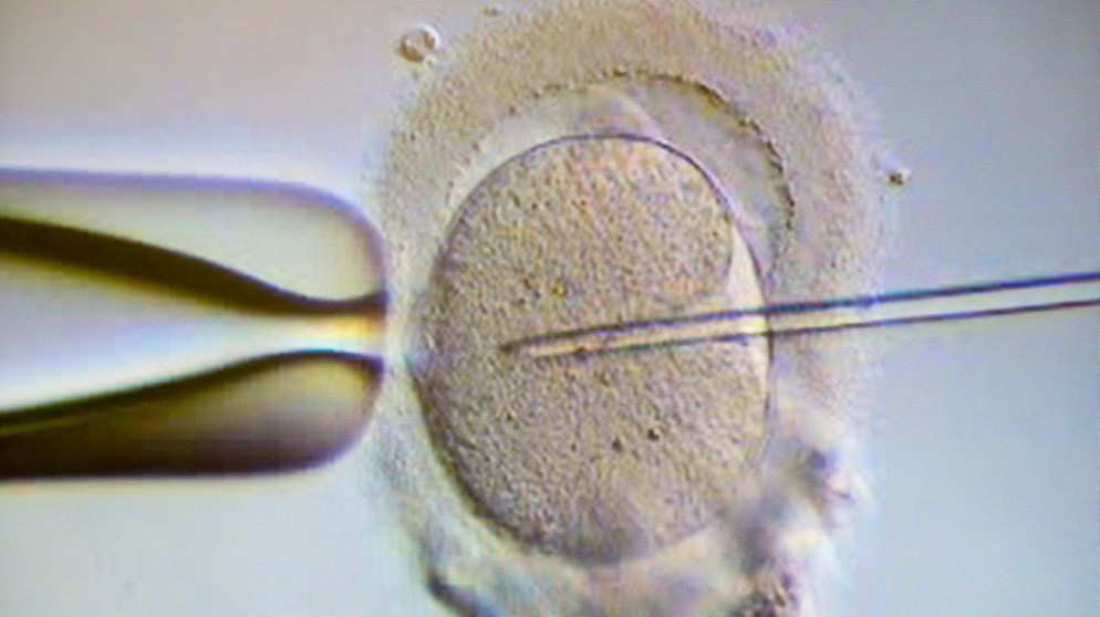 Künstliche Befruchtung: Ein Monitor zeigt eine Intrazytoplasmatische Spermieninjektion (ICSI). Bei der Behandlung wird einer Eizelle ein Spermium injiziert. | Bild: picture alliance/Klaus-Dietmar Gabbert/dpa-Zentralbild/ZB