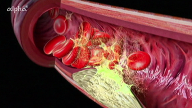 Grafische Darstellung Blut- und Atmungskreislauf | Bild: BR