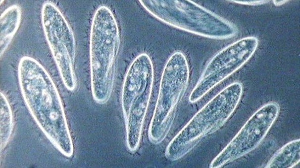 Pantoffeltierchen unterm Mikroskop | Bild: BR