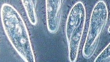 Pantoffeltierchen unterm Mikroskop | Bild: BR
