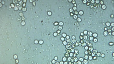 Hefezellen unter dem Mikroskop | Bild: BR