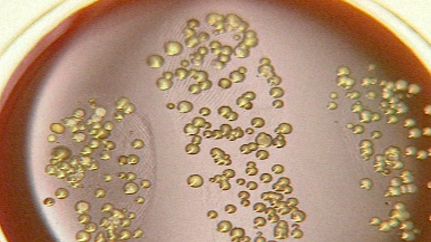 Bakterien wachsen in einer Petrischale | Bild: BR