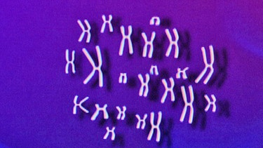 Chromosomen | Bild: BR