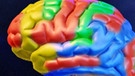 Das Gehirn und seine verschiedenen Felder | Bild: BR