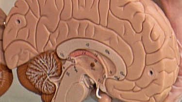 Modell zweier Gehirnhälften | Bild: BR