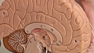 Modell zweier Gehirnhälften | Bild: BR