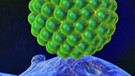 Modell eines HI-Virus | Bild: BR