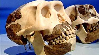Schädel von Homo erectus | Bild: BR