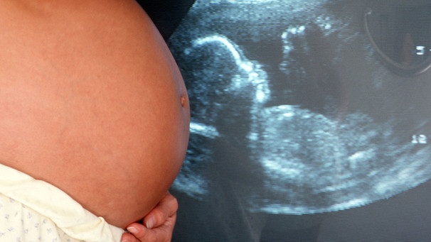 Schwangere mit Ultraschallbild | Bild: picture-alliance/dpa