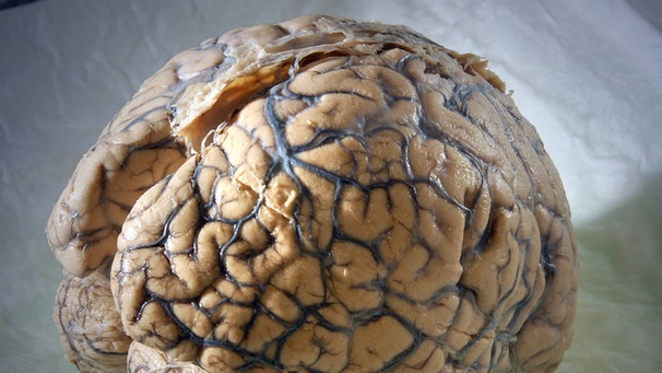 menschliches Gehirn | Bild: picture-alliance/dpa