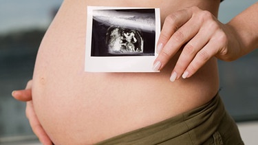 Schwangere Frau zeigt Ultraschallbild | Bild: Image Source