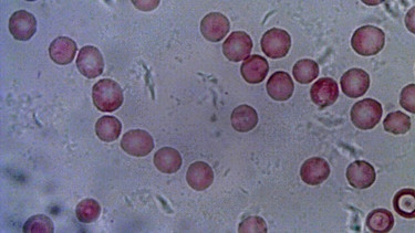 Mikroskopische Aufnahme von Blutzellen. | Bild: picture-alliance/dpa