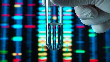 Symbolbild: Genforschung, Reagenzglas vor einem DNA-Profil. Das menschliche Genom wurde vor über 20 Jahren entschlüsselt, jetzt macht sich die Forschung auf die Suche des Pangenoms. Das Pangenom soll das Erbgut der gesamten Menschheit abbilden, mit all seinen Varianten und Abweichungen.  | Bild: picture-alliance/dpa