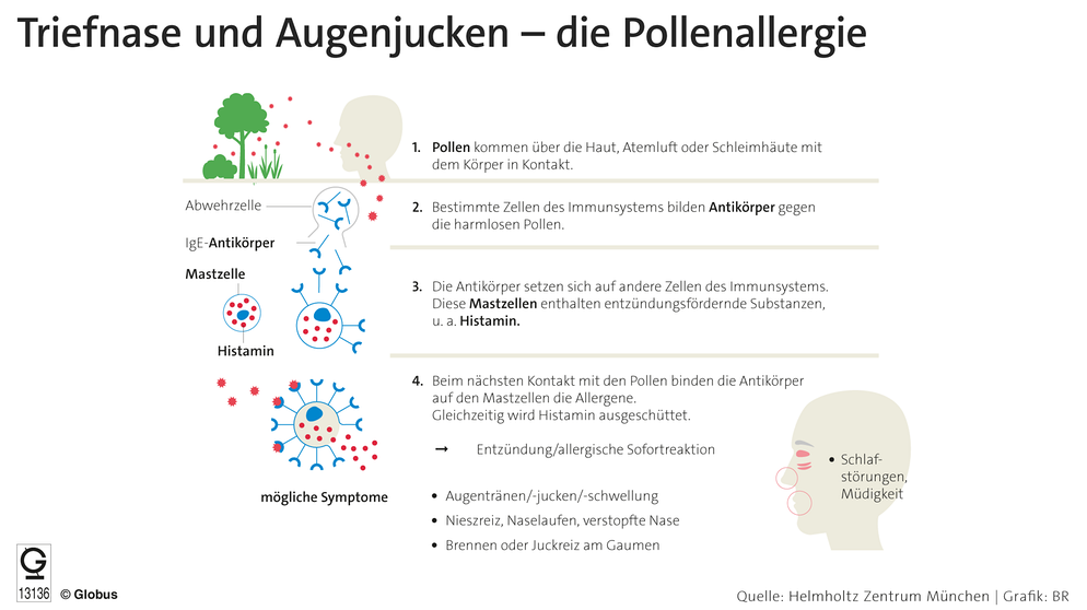 Grafik: Das passiert bei Heuschnupfen im Körper | Bild: picture-alliance/ dpa-infografik | dpa-infografik