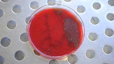 Analyse der Blutwerte sowie der Identifizierung der Krankheitskeime.  | Bild: picture-alliance/dpa
