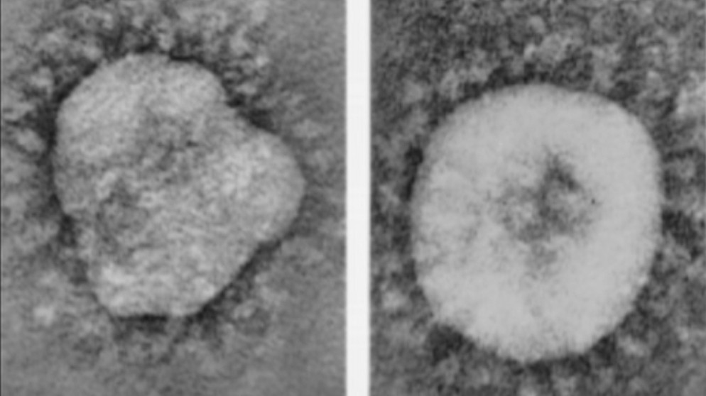 Die Coronaviren 229E (2) und B814 (3) unter dem Elektronenmikroskop, 1966  | Bild: June D. Almeida and D. A. J. Tyrrell, CC0, via Wikimedia Commons