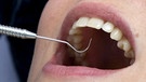 Beim Zahnarzt | Bild: picture alliance / blickwinkel