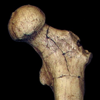 Der Oberschenkelknochen eines vor sechs Millionen Jahren gestorbenen Homininen (Orrorin tugenensis femur). | Bild: David Alba/dpa-Bildfunk