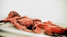 Mumie von Ötzi. Eine neue Erbgutanalyse von Ötzi zeigt: Er sah anders aus als bisher angenommen. Auch woher Ötzi stammt, ist jetzt klarer. Wurde Ötzi ermordet?  | Bild: picture-alliance/dpa