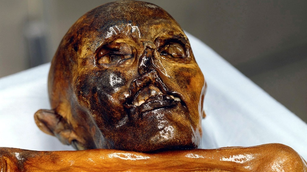 Ötzi. Neue Analysen von Ötzis Erbgut verraten, wie Ötzi ausgesehen hat. Hatte er dunklere Haut und weniger Haare als bisher angenommen? Die Eismumie hatte zudem gebrochene Rippen und Narben: Wurde er vor 5.300 Jahren ermordet? | Bild: picture-alliance/dpa