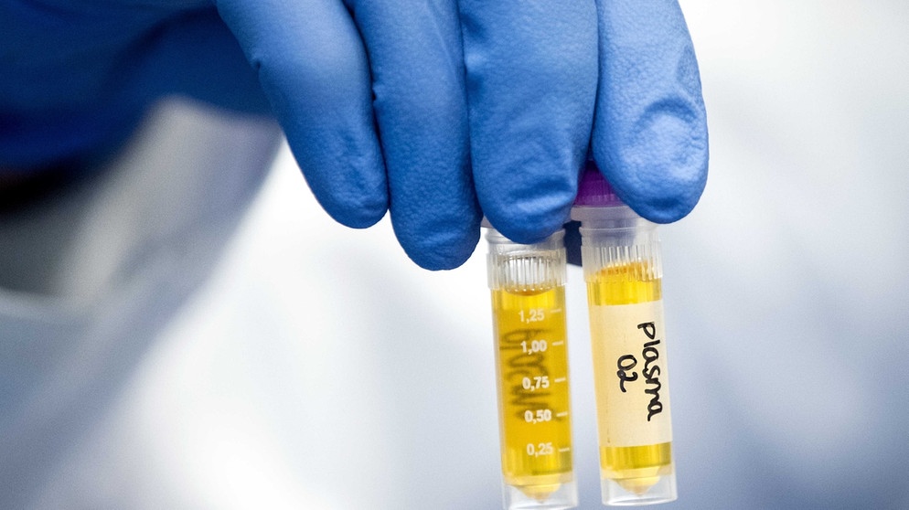 Reagenzgläser mit Blutplasma während serologischer Antikörpertests während der Corona-Pandemie im Labor eines Krankenhauses.  | Bild: picture-alliance/dpa/ANP/Sem van der Wa