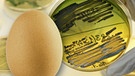 Ein Hühnerei und ein Nährboden im Labor mit dem Bakterium Salmonella Enteritidis. | Bild: colourbox.com; picture-alliance/dpa; Montage: BR