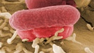 Ehec-Erreger | Bild: Manfred Rohde, Helmholtz-Zentrum für Infektionsforschung