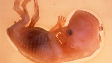 Menschlicher Embryo | Bild: picture-alliance/dpa