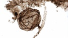 Pilzfossilien von Ourasphaira giraldae | Bild: dpa-Bildfunk/Corentin C. Loron