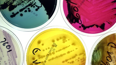 Salmonellen in der Petrischale | Bild: picture-alliance/dpa