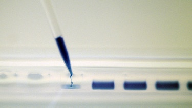 Eine DNA-Probe wird in einem Labor mit einer Pipette auf Gel aufgetragen | Bild: picture-alliance/dpa 