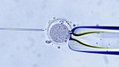 Injektion von Spermium in die Eizelle unter dem Mikroskop | Bild: picture alliance/imageBROKER