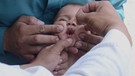 Ein Baby bekommt eine Schluckimpfung gegen Polio, also Kinderlähmung | Bild: picture alliance