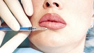 Haut: Bodoxoperation an der Lippe und unterhalb | Bild: colourbox.com