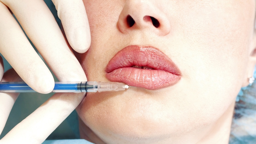 Haut: Bodoxoperation an der Lippe und unterhalb | Bild: colourbox.com