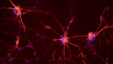 Nervenzellen von Mäusen | Bild: picture alliance / BSIP | NIH / IMAGE POINT FR