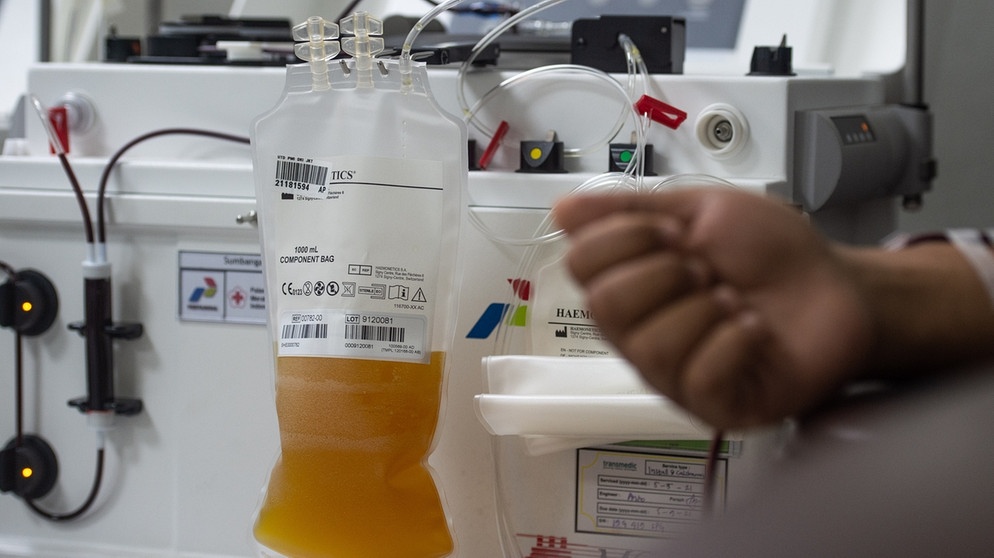 Zu sehen ist eine Blutplasma-Transfusion. Können wir Menschen bald schon viel länger und gesünder leben? Wir erklären euch aussichtsreiche wissenschaftlichen Entdeckungen der Alternsforschung für ein gesundes Altern und ein längeres Leben. | Bild: picture alliance/Xinhua News Agency | Veri Sanovri
