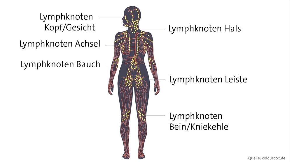 Wie viele Lymphknoten hat der Mensch? Rund 600 Lymphknoten besitzen wir im ganzen Körper verteilt. Die meisten der kidneybohnenförmigen Knubbel befinden sich in den Achselhöhlen, am Hals, in der Leistengegend und in der Kniebeuge. | Bild: colourbox.com, Montage: BR