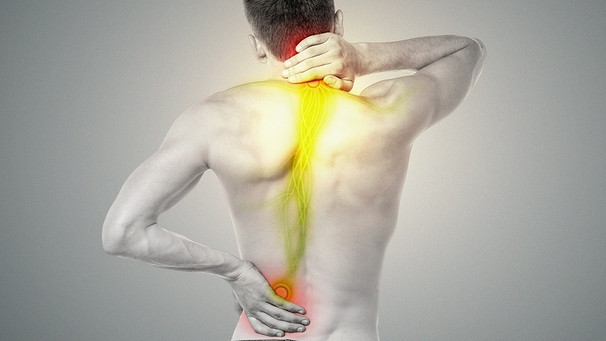 Mann von hinten mit nacktem Oberkörper, wo farblich markiert ist, wo überall Rückenschmerzen plagen können. | Bild: colourbox.de