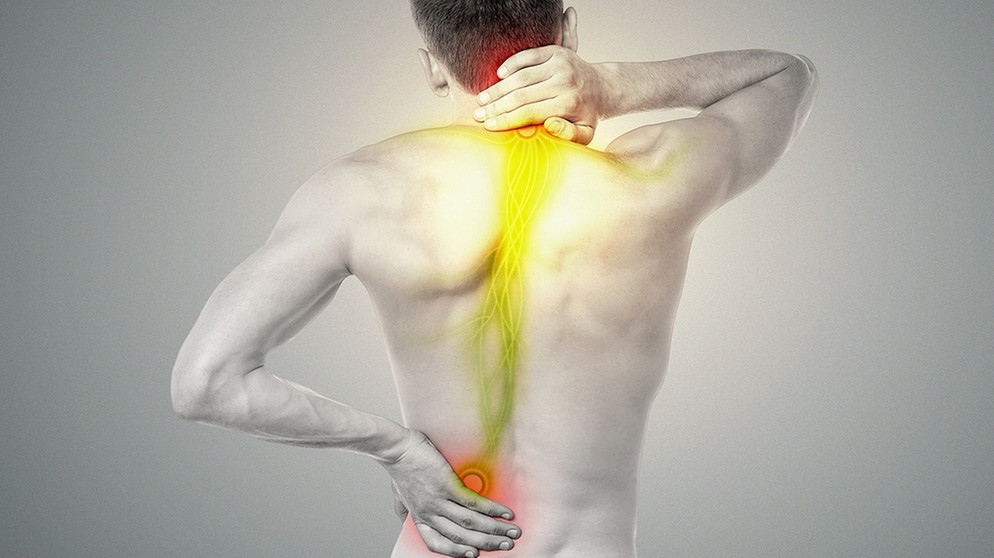 Mann von hinten mit nacktem Oberkörper, wo farblich markiert ist, wo überall Rückenschmerzen plagen können. | Bild: colourbox.de