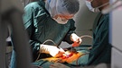 Ärzte-Team während einer Rückenoperation | Bild: picture-alliance/dpa