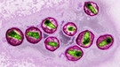 HI-Viren, die die Immunschwächekrankheit AIDS auslösen können. | Bild: picture-alliance/dpa / BSIP / CAVALLINI JAMES