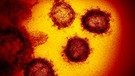 Coronavirus 2019-nCoV | Bild: picture alliance / AP Images