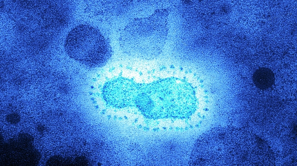 Durchfall durch Coronaviren | Bild: picture-alliance/dpa