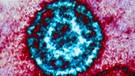 Epstein-Barr-Virus | Bild: picture alliance/BSIP