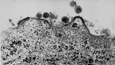 HIV Virus, der von Luc Montagnier im Pasteur Institut in Paris entdeckt wurde | Bild: picture-alliance/dpa/Uncredited