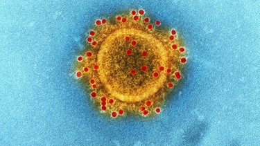 MERS-Virus aus dem Jahr 2012: Middle East Respiratory Syndrome | Bild: picture alliance/NIAID