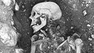 Forscher entdeckten auf der schwedischen Insel Öland ein ursprünglich mit Pocken infiziertes Wikinger-Skelett. | Bild: The Swedish National Heritage Board