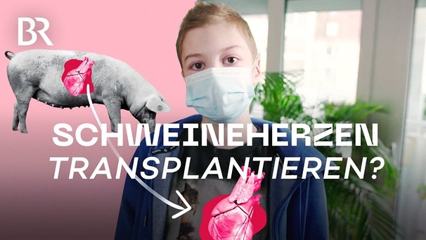Wie Tiere zum Organspender für Menschen werden - Xenotransplantation | beta stories | Doku | BR | Bild: beta stories (via YouTube)